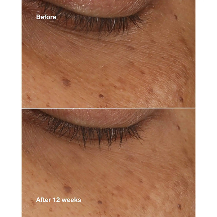 سرم ضد چروک و رفع تیرگی دور چشم کلینیک مدل All About Eyes مناسب برای انواع پوست حجم 10 میلی لیتر