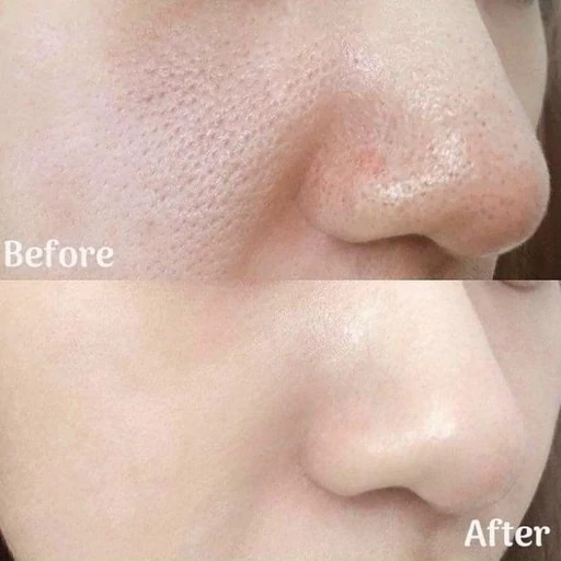 سرم آمپول لایه بردار و روشن کننده پیل شات برنج دکتر ملاکسین