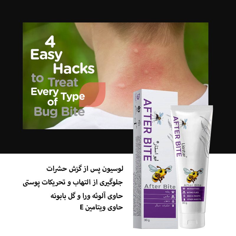 لوسیون پس از گزش حشرات لیو استار مدل After bite3 حجم 30 گرم بسته سه عددی